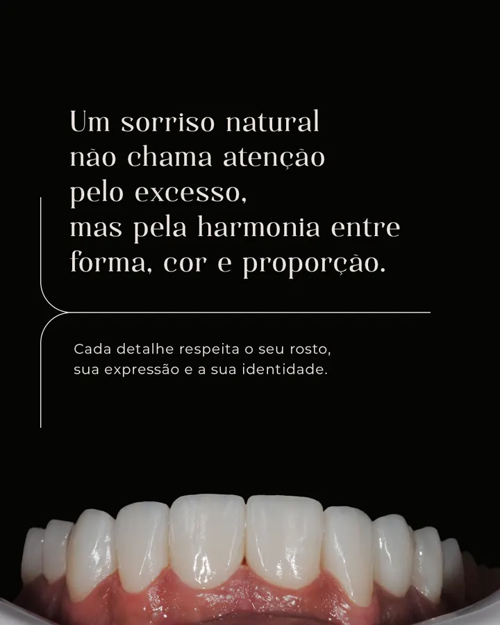 Post “Um sorriso natural não chama atenção pelo excesso”, em fundo preto.